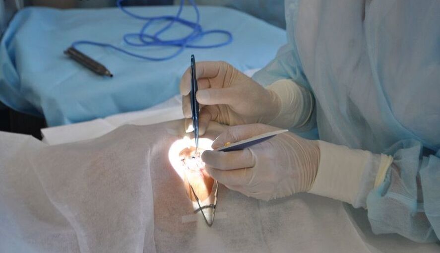 Eye surgery to restore vision