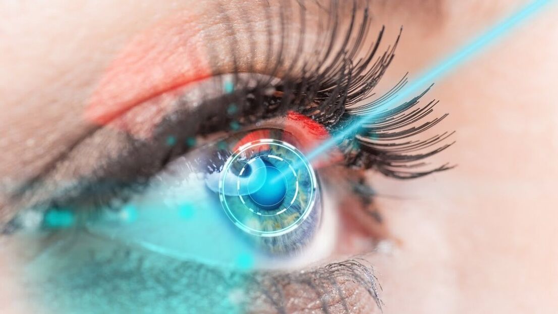 Restoration of vision by laser correction